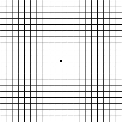 The Amsler Grid